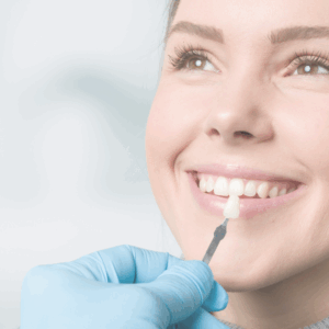 Bonded Ceramic Restorations