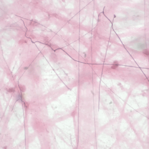 Soft Tissue Management In Restorative Dentistry